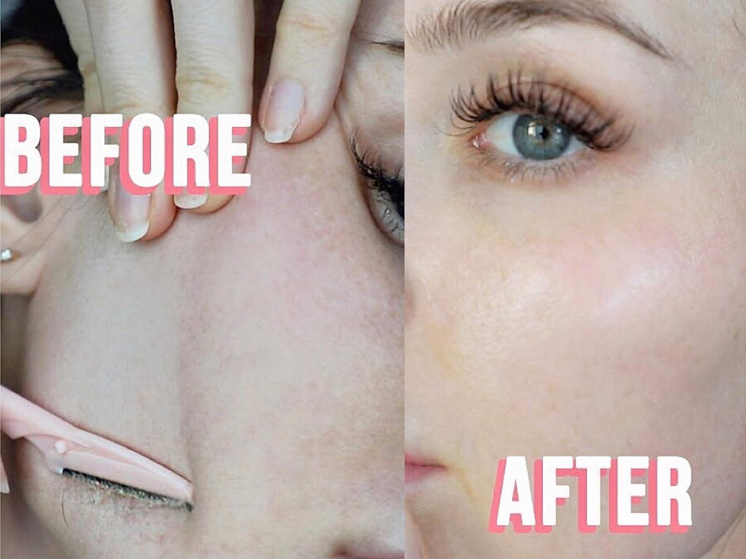 ILLUVA Hårborttagare för ansiktshår, ögonbryn, rakhyvel, rakapparat, trimmer, formande, exfolierande ”dermaplaning”-verktyg för kvinnor och män, 6 stycken